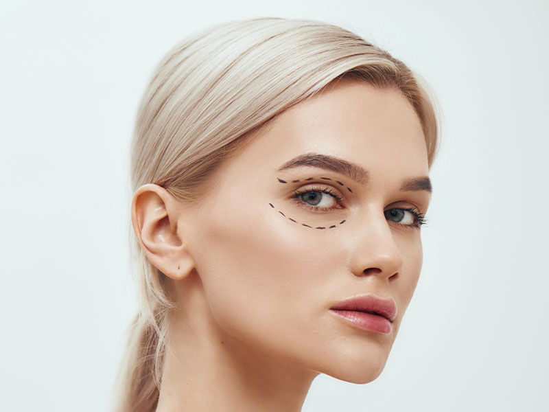 Blefaroplastika-operacija-i-korekcija-gornjih-i-donjih-ocnih-kapaka
