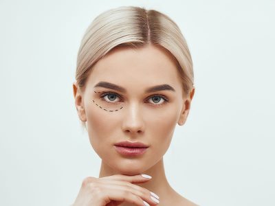 Blefaroplastika-oporavak